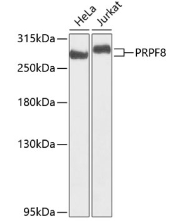 PRPF8 Rabbit Polyclonal Antibody