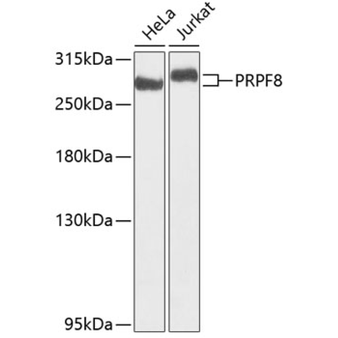 PRPF8 Rabbit Polyclonal Antibody