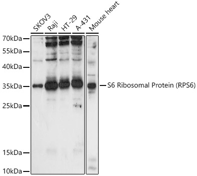 S6 Ribosomal Protein (RPS6) Rabbit Polyclonal Antibody