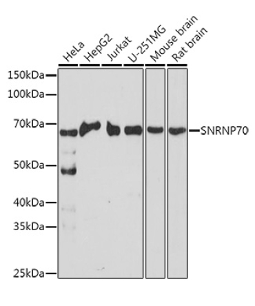 SNRNP70 Rabbit Polyclonal Antibody