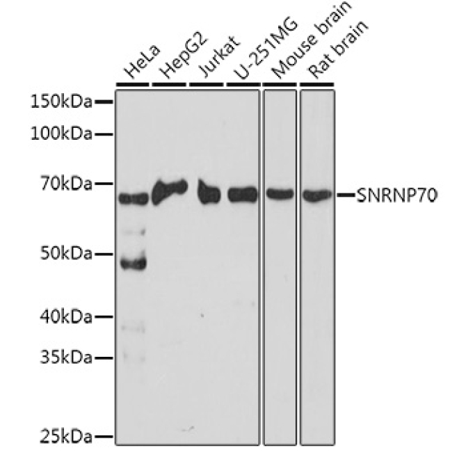 SNRNP70 Rabbit Polyclonal Antibody