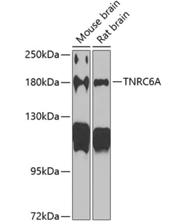 TNRC6A Rabbit Polyclonal Antibody