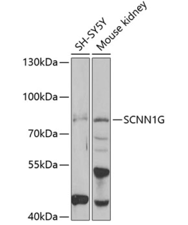 SCNN1G Rabbit Polyclonal Antibody
