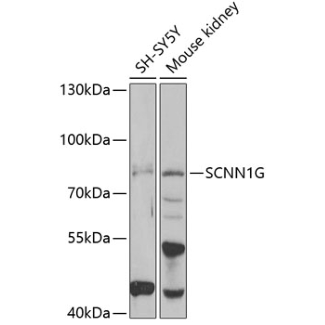 SCNN1G Rabbit Polyclonal Antibody