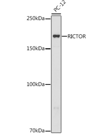RICTOR Rabbit Polyclonal Antibody