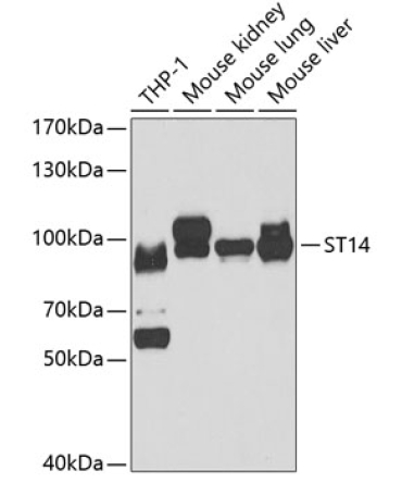 ST14 Rabbit Polyclonal Antibody