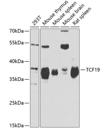 TCF19 Rabbit Polyclonal Antibody