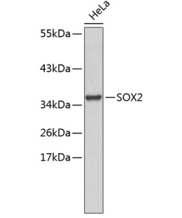 SOX2 Rabbit Polyclonal Antibody