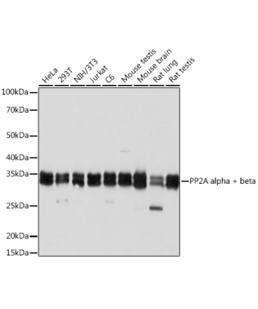 PP2A alpha + beta Rabbit Monoclonal Antibody