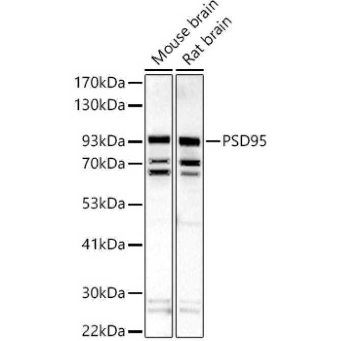 PSD95 Rabbit Polyclonal Antibody