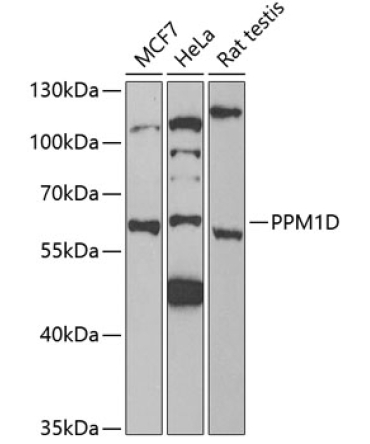PPM1D Rabbit Polyclonal Antibody
