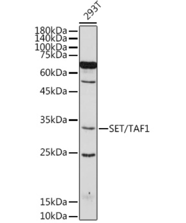 SET/TAF1 Rabbit Polyclonal Antibody