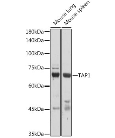 TAP1 Rabbit Polyclonal Antibody