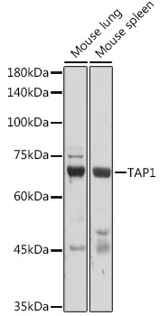 TAP1 Rabbit Polyclonal Antibody