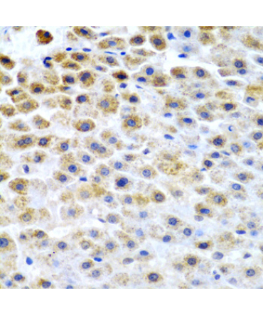 TFPI2 Rabbit Polyclonal Antibody