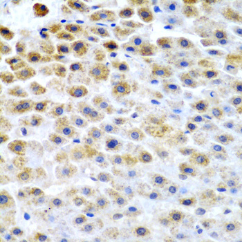 TFPI2 Rabbit Polyclonal Antibody