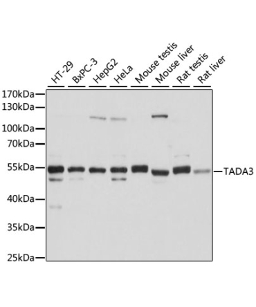 TADA3 Rabbit Polyclonal Antibody