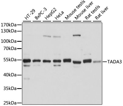 TADA3 Rabbit Polyclonal Antibody
