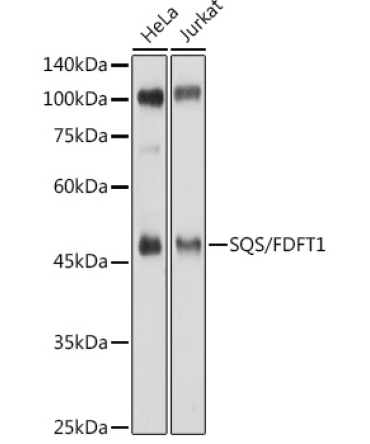 SQS/FDFT1 Rabbit Polyclonal Antibody