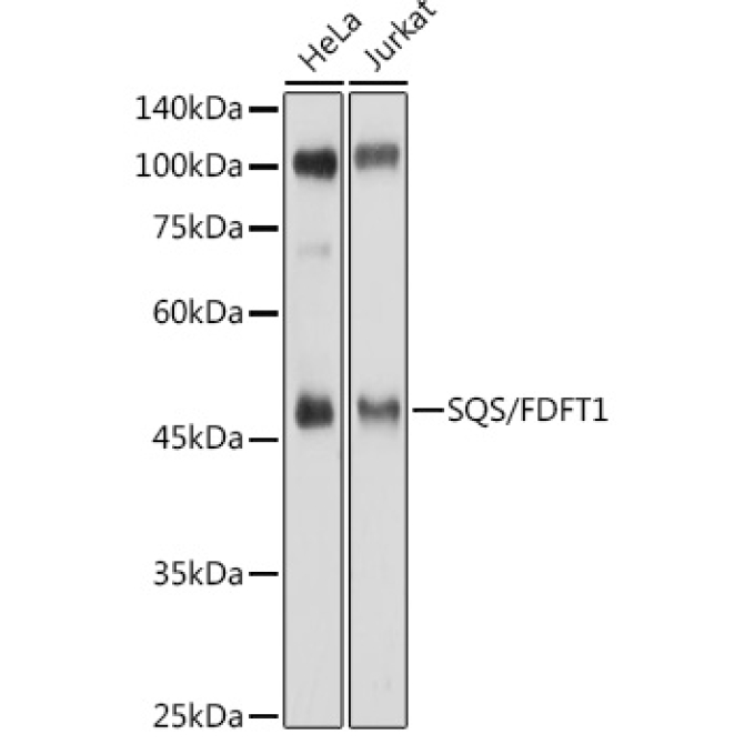SQS/FDFT1 Rabbit Polyclonal Antibody
