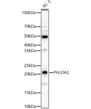 PHLDA2 Rabbit Polyclonal Antibody