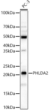 PHLDA2 Rabbit Polyclonal Antibody
