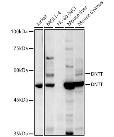 TdT Rabbit Polyclonal Antibody