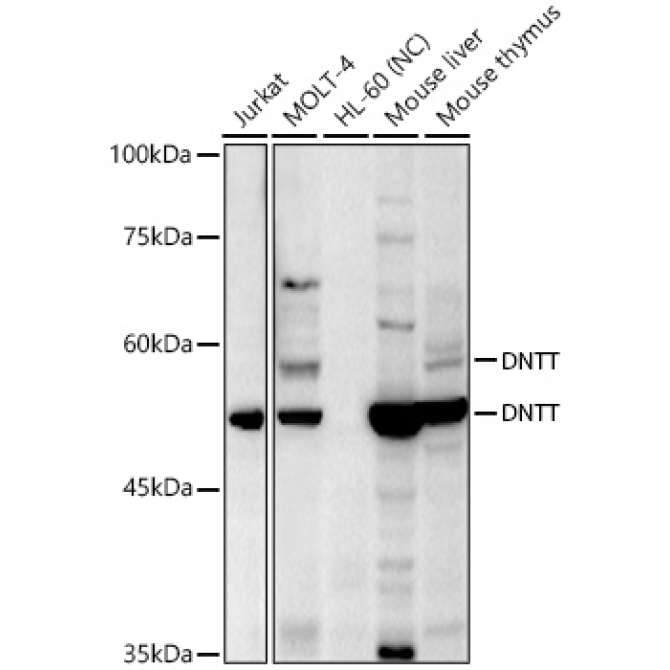 TdT Rabbit Polyclonal Antibody