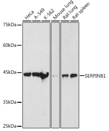 SERPINB1 Rabbit Polyclonal Antibody