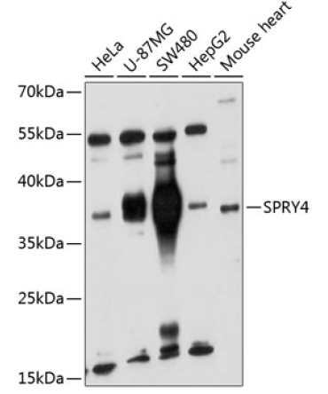 SPRY4 Rabbit Polyclonal Antibody
