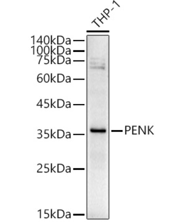 PENK Rabbit Polyclonal Antibody