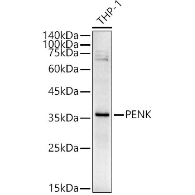 PENK Rabbit Polyclonal Antibody