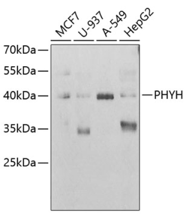 PHYH Rabbit Polyclonal Antibody