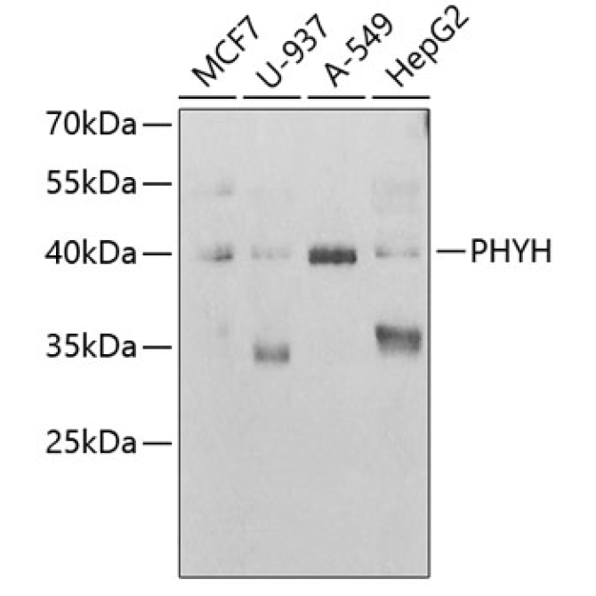 PHYH Rabbit Polyclonal Antibody