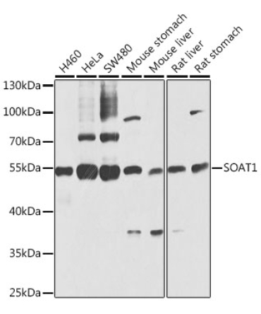 SOAT1 Rabbit Polyclonal Antibody
