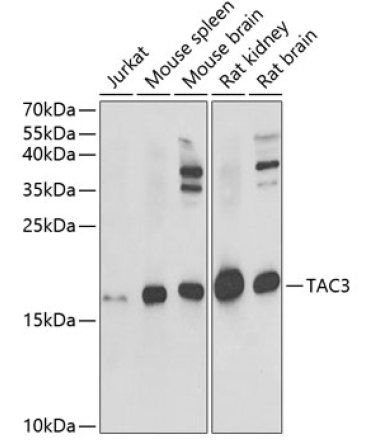 TAC3 Rabbit Polyclonal Antibody