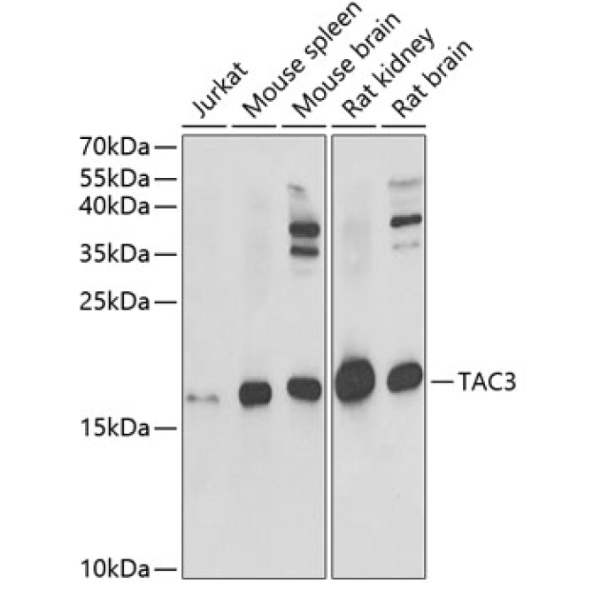 TAC3 Rabbit Polyclonal Antibody