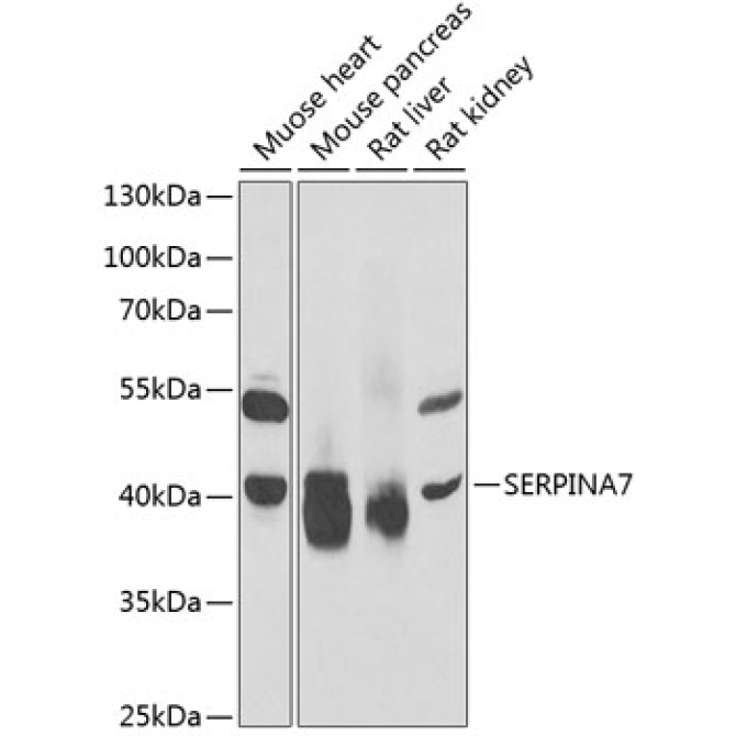 SERPINA7 Rabbit Polyclonal Antibody