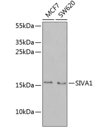 SIVA1 Rabbit Polyclonal Antibody