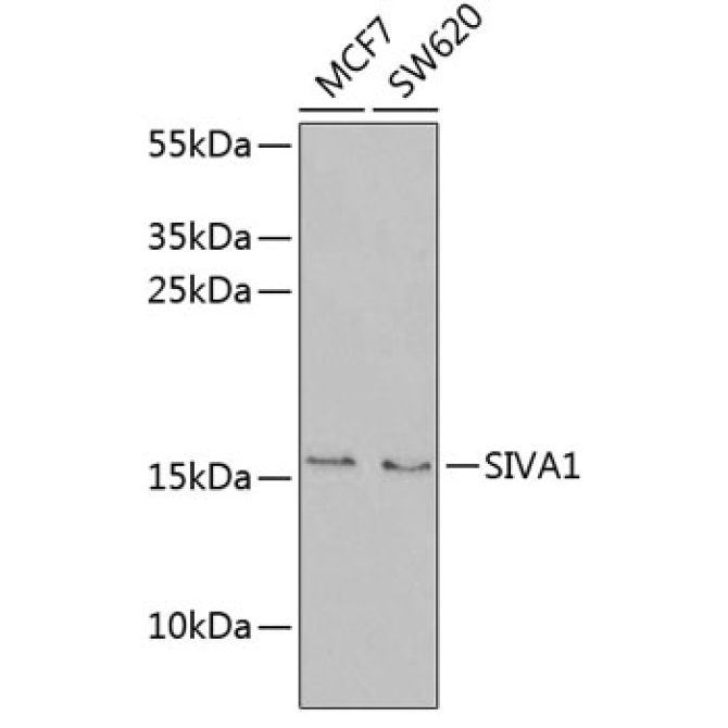 SIVA1 Rabbit Polyclonal Antibody