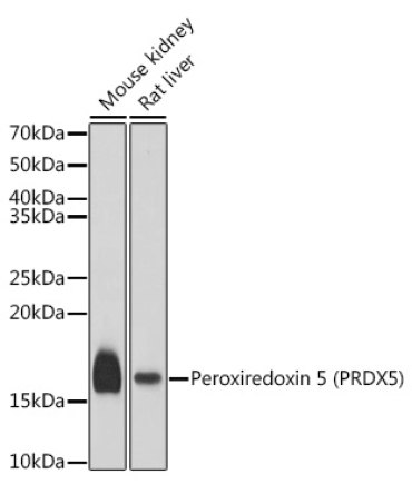 Peroxiredoxin 5 (PRDX5) Rabbit Polyclonal Antibody