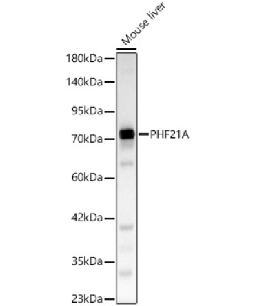 PHF21A Rabbit Polyclonal Antibody