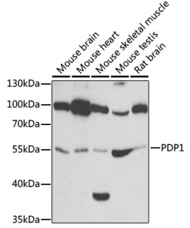 PDP1 Rabbit Polyclonal Antibody