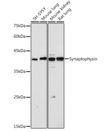 Synaptophysin Rabbit Polyclonal Antibody