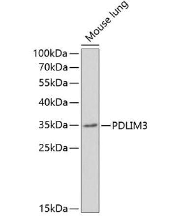 PDLIM3 Rabbit Polyclonal Antibody