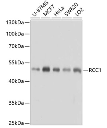 RCC1 Rabbit Polyclonal Antibody