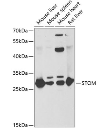 STOM Rabbit Polyclonal Antibody