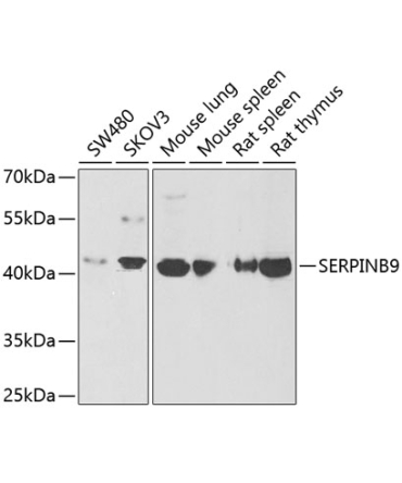 SERPINB9 Rabbit Polyclonal Antibody