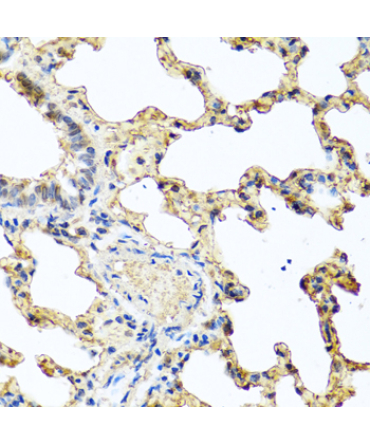 PIP Rabbit Polyclonal Antibody