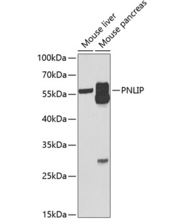 PNLIP Rabbit Polyclonal Antibody